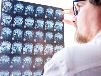 UCLA Adolescent Epilepsy Center