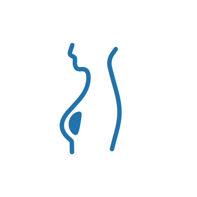 أورام سرطان الثدي