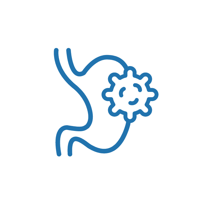  أورام الجهاز الهضمي 