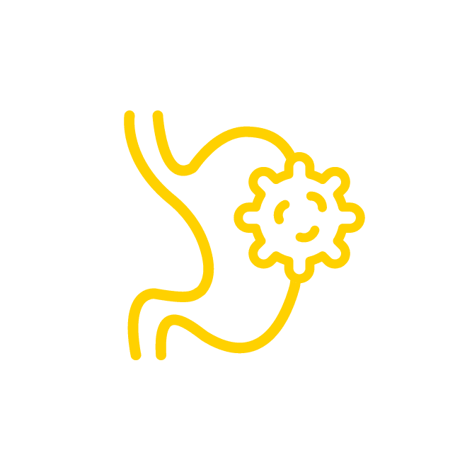  أورام الجهاز الهضمي 