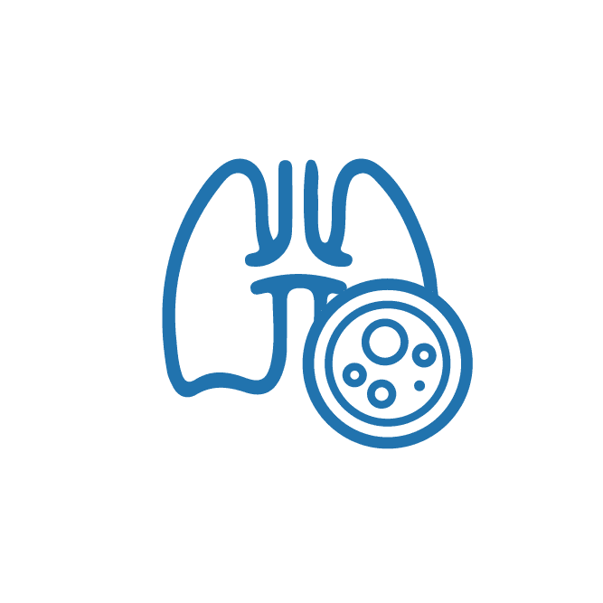 أورام سرطان الرئة