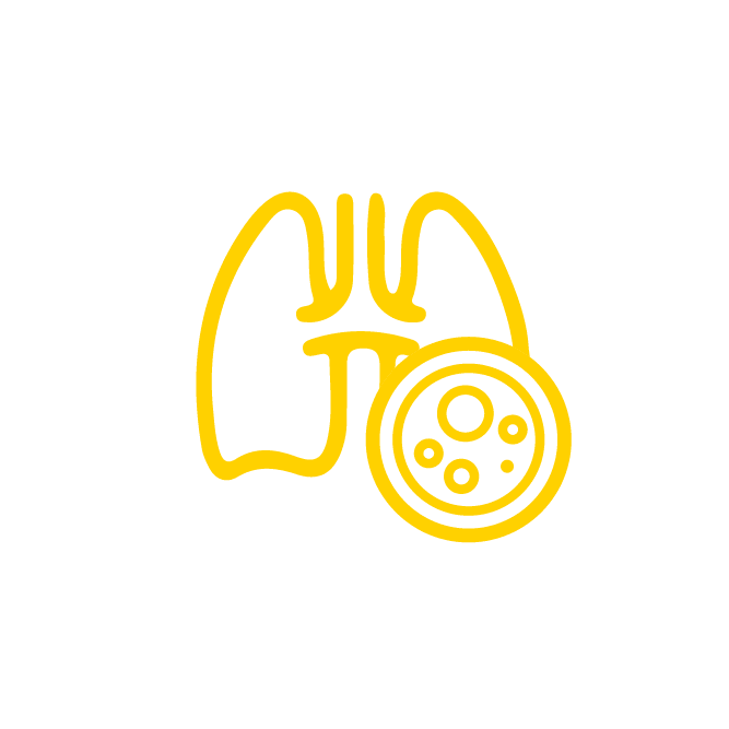 أورام سرطان الرئة