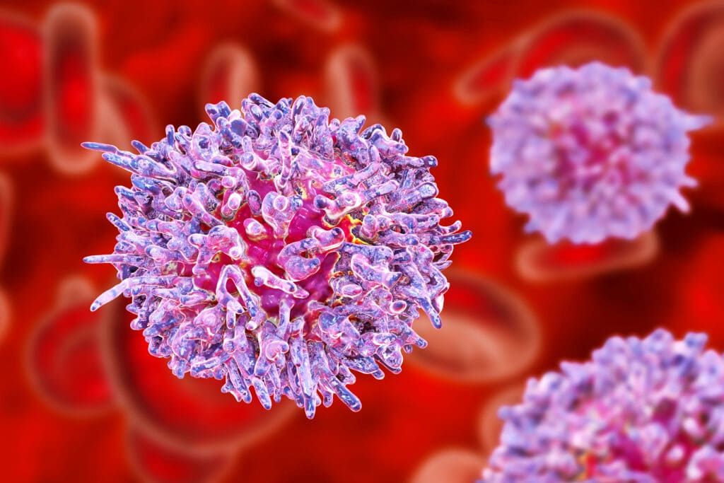 متلازمة خلل التنسج النخاعي